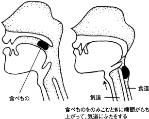 ダイアグラム